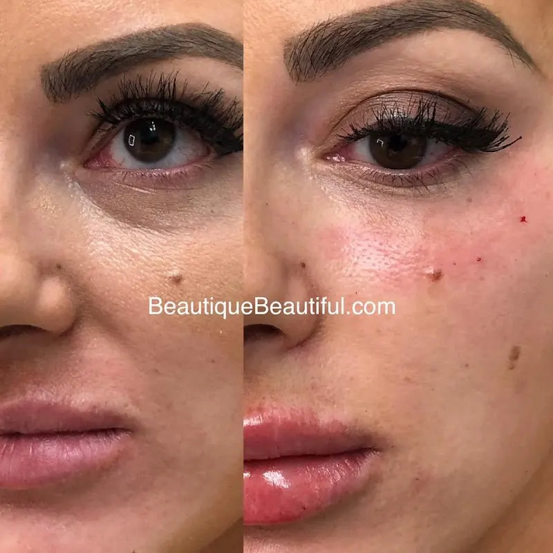 Beautique Medical Anti-Aging — Medical spa in Knoxville
